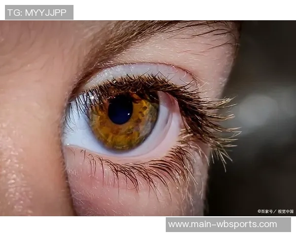 西媒揭示赫伊森眼睛难以睁开的原因是先天性眼睑下垂但不影响视力